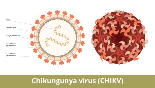 Chikungunya