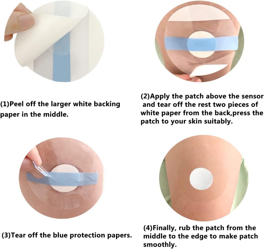 Best Overpatch for FreeStyle Libre 3 & Libre 3 Plus (Waterproof, 14-Day Wear Tested)